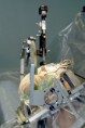 /album/pictures/a402px-parkinson-surgery-jpg/